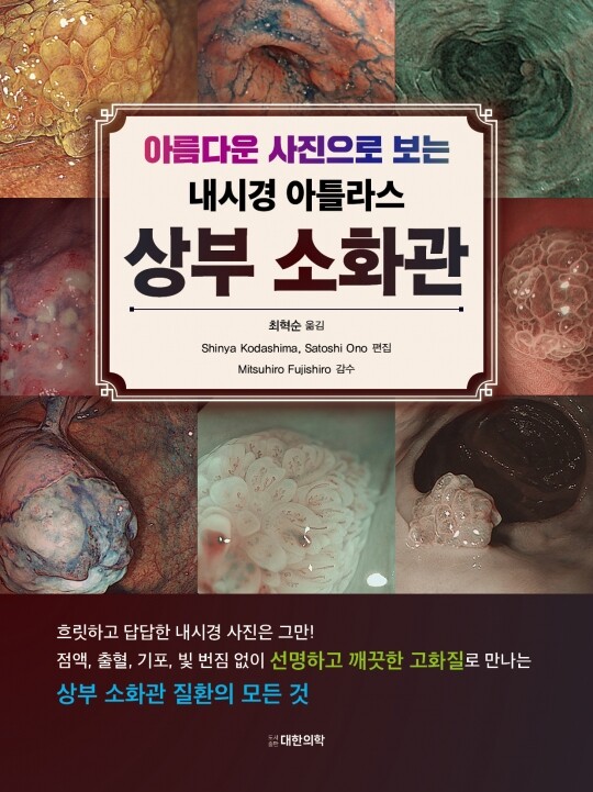 아름다운 사진으로 보는 내시경 아틀라스 상부 소화관