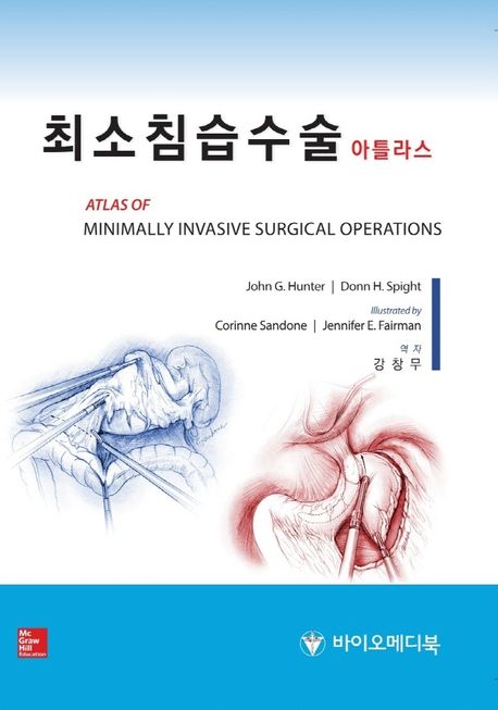최소침습수술 아틀라스