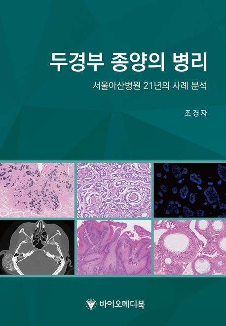 두경부 종양의 병리-서울아산병원 21년의 사례 분석
