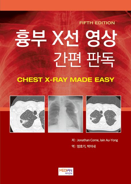 흉부 X선 영상 간편 판독(Chest X-Ray Made Easy)